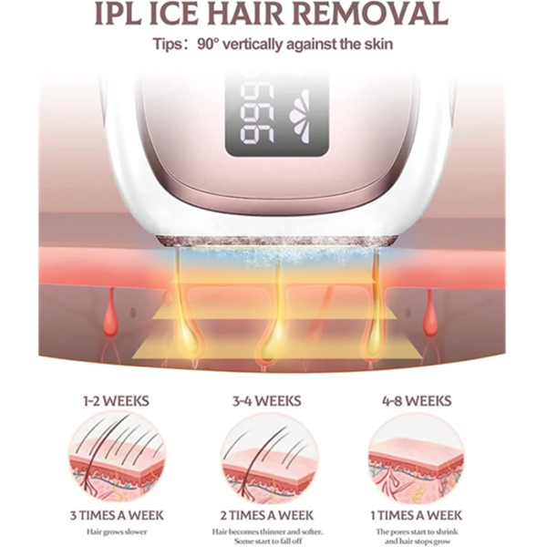 دستگاه لیزر موهای زائد خانگی IPL TM002 مجهز به خنککننده یخی (Ice Compress) و ۹۹۹ هزار شات سفارش آلمان اورجینال