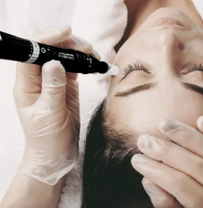 قلم میکرونیدلینگ ژنوسیس مدل Pen-K دارای ضمانت اصالت کالا