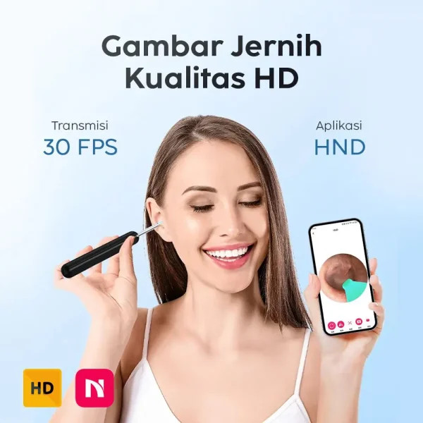 گوش پاکن هوشمند بصری مدل NE6